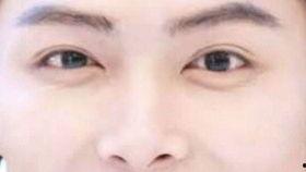 黑花张日山吃瓜,揭秘娱乐圈的“吃瓜”风云